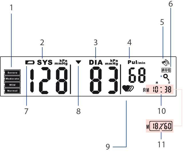 display display